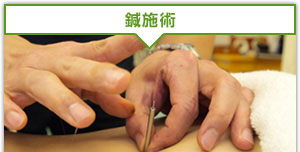 鍼治療
