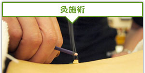 灸治療